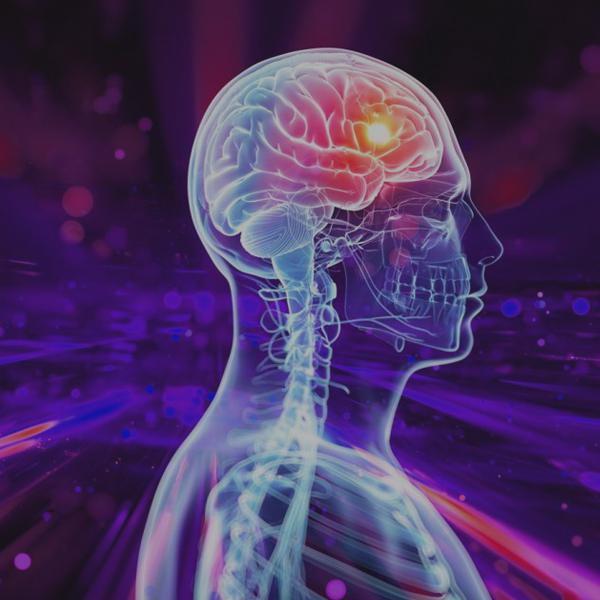 Epilepsy image