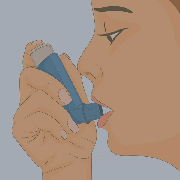 Asthma  